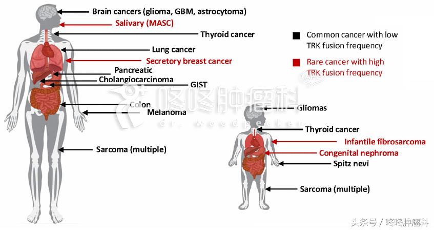 larotrectinib是靶向药吗,larotrectinib的靶向药