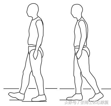 acl重建能恢复正常韧带强度吗,acl自体韧带重建康复训练