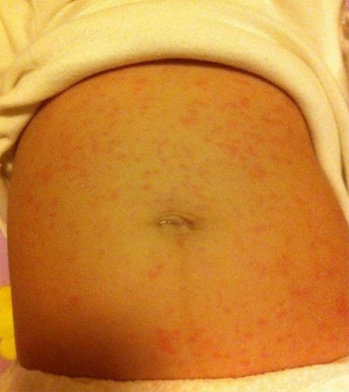 骞煎効鎬ョ柟鍖荤敓缁欏紑浜嗕粈涔堣嵂,骞煎効鎬ョ柟鏃跺濡堣鎬庝箞蹇屽彛