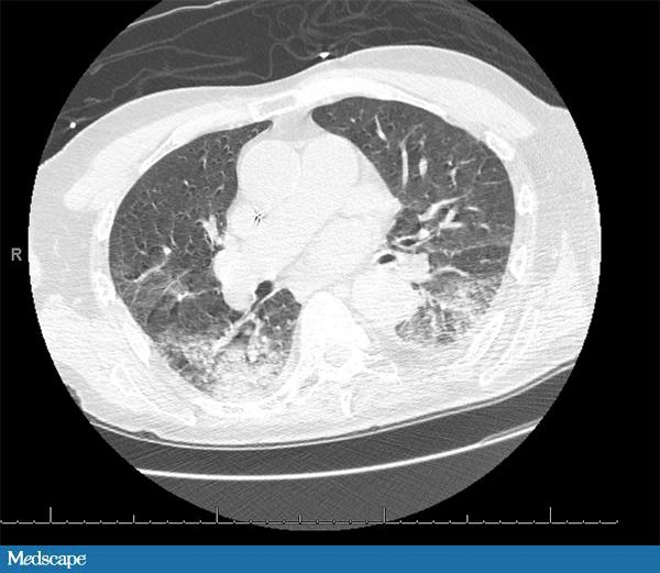 抗菌素的合理使用指南,国外抗菌药的合理使用
