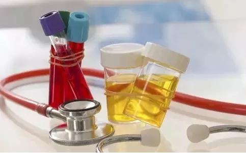 尿频尿急尿痛最常见于肾盂肾炎,肾盂肾炎尿频尿急的方法