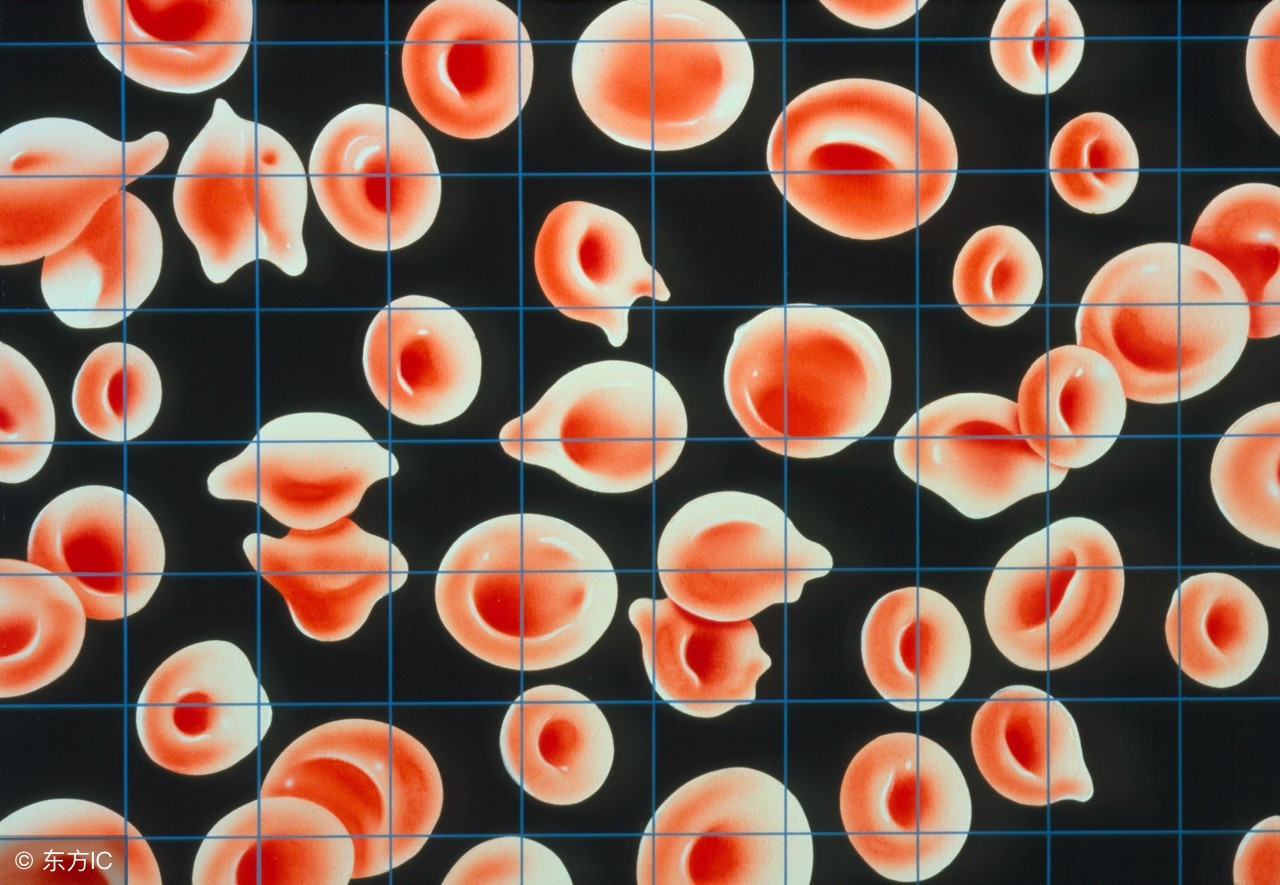 10个月宝宝贫血怎么补,宝宝贫血怎么办一招教你搞定