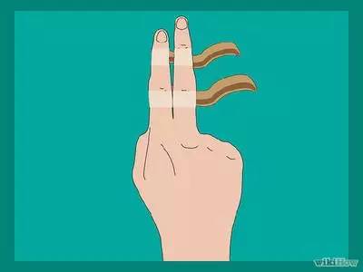 手指吃了萝卜怎么处理继续打球,手指吃了萝卜肿了怎么办