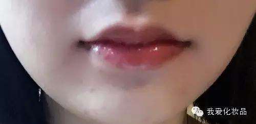 油皮痘肌适合的护肤品牌子,混油皮痘肌适用的护肤品推荐