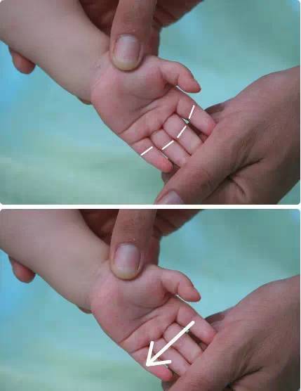 小儿推拿止咳化痰手法图解,小儿推拿三分钟退烧手法图解