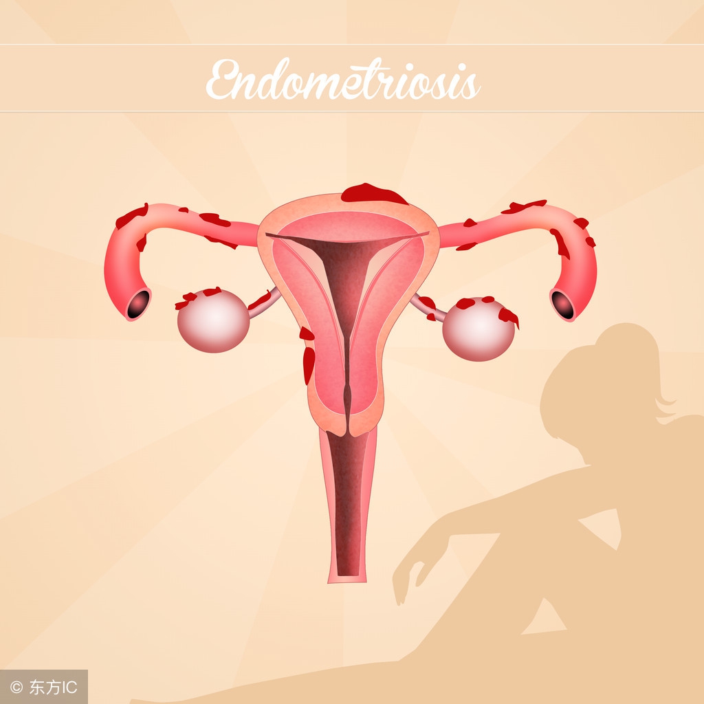 老年妇女子宫脱垂最好解决办法,子宫脱垂对老年女性有哪些危害