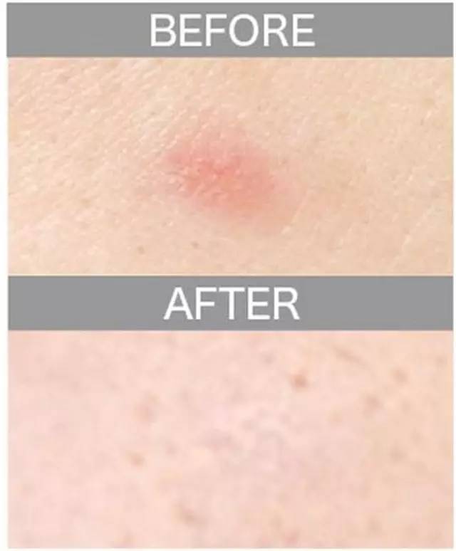 遮瑕膏排行榜10强混合皮肤,比较不错的三色遮瑕膏推荐