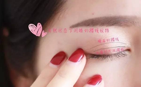 内双如何自然地变成双眼皮?