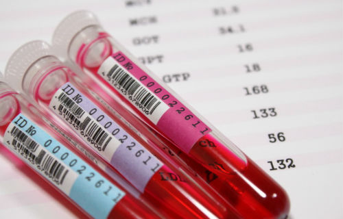 亲子鉴定烟头准确率有多少,烟头污染了亲子鉴定结果准确吗