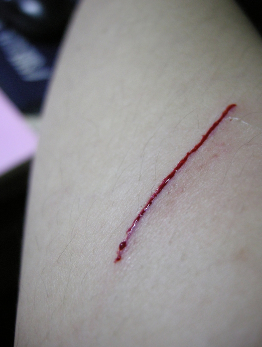 亲子鉴定烟头准确率有多少,烟头污染了亲子鉴定结果准确吗