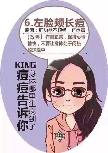 脸上痘痘分布说明身体什么问题,专家讲解痘痘经验