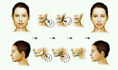 关于瘦脸针的几个常识问题,解密瘦脸针的几大常识性问题