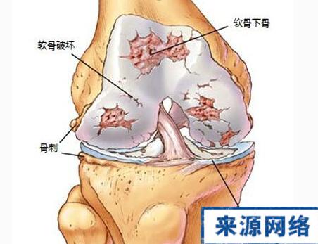 有关“老寒腿”讲解的最明白的文章！（太赞了）