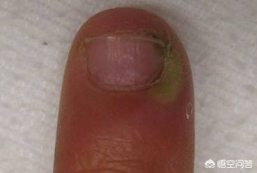 靶向治疗需要几天恢复,服用靶向药几个小时后出现副反应