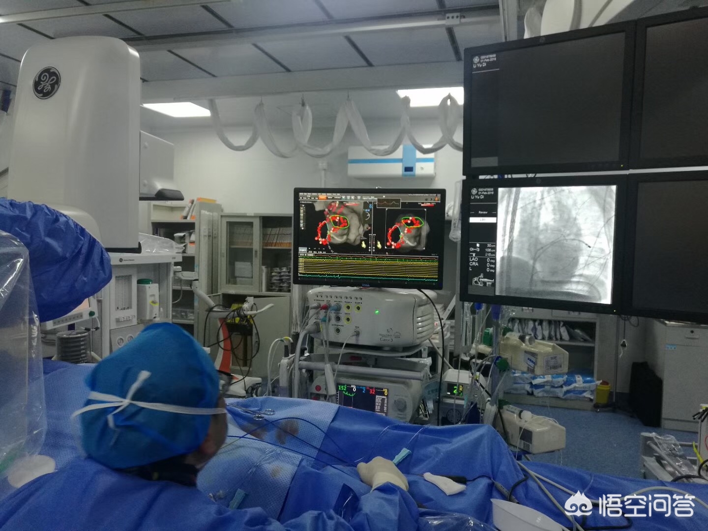 房颤患者需要做手术治疗吗,房颤可以药物控制吗