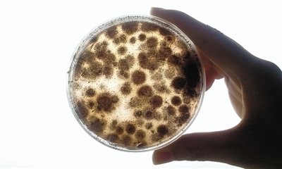 夏天高发的阴道炎，如何远离它的侵扰？