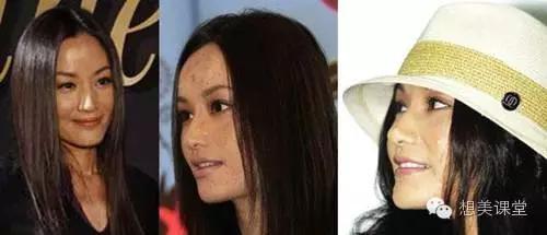 脸再美妆再浓，一颗痘痘毁你容！