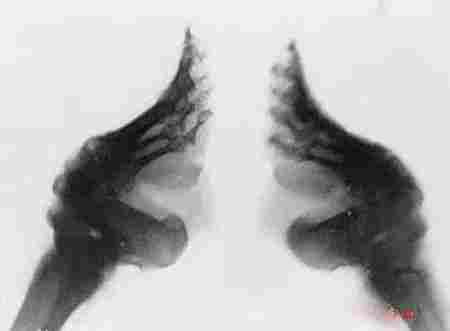 古代裹小脚真实过程,中国历史上的畸形审美