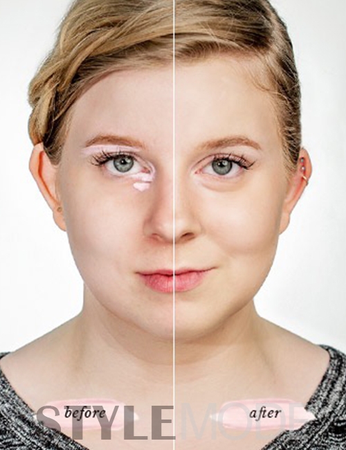 矫正肤色靠谱吗,肤色改正