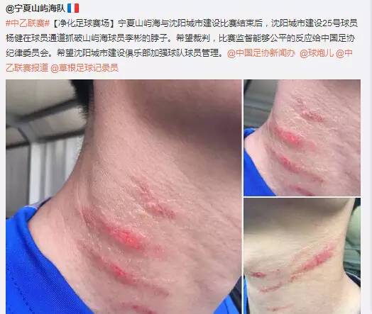足球丨宁夏山屿海首次登顶榜首！谴责：沈阳球员竟然赛后下黑手！