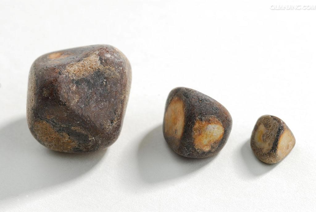 乙肝警惕肝硬化的出现,乙肝的并发症有哪些