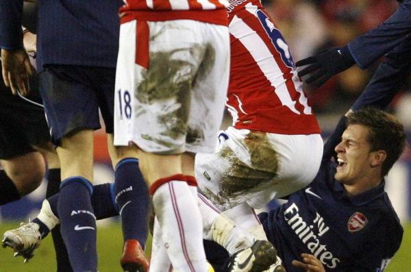 世界足坛十大断腿事件,足球史上十大最恐怖的断腿