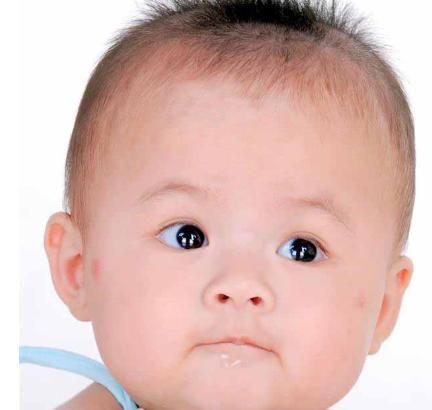 如何区分宝宝痱子和湿疹,痱子和湿疹的区别一张图