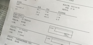 做四维医生说宝宝胎动幅度不大,四维胎动频繁和不怎么活泼对比