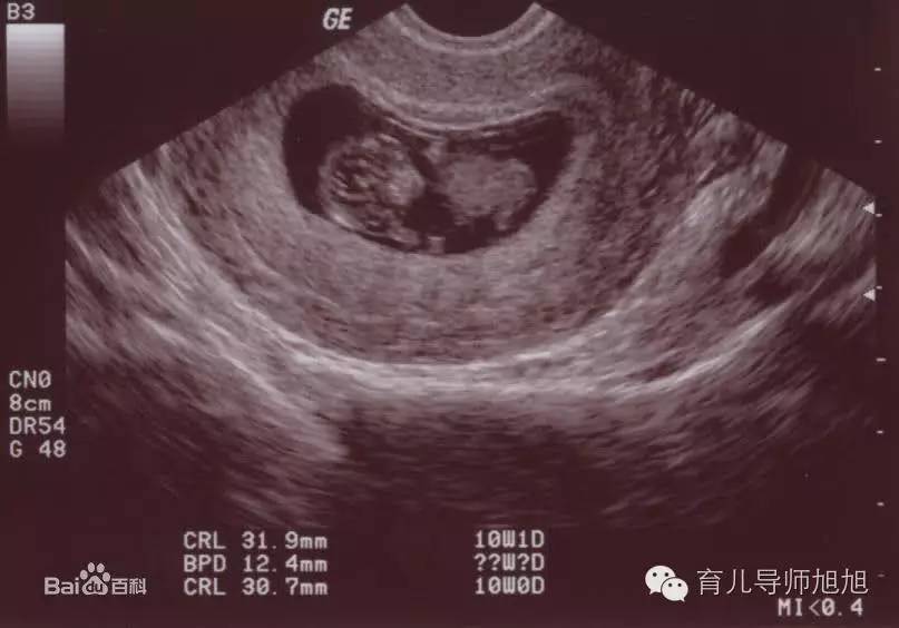 新生儿浑身发紫口吐白沫,新生儿口吐白沫死亡