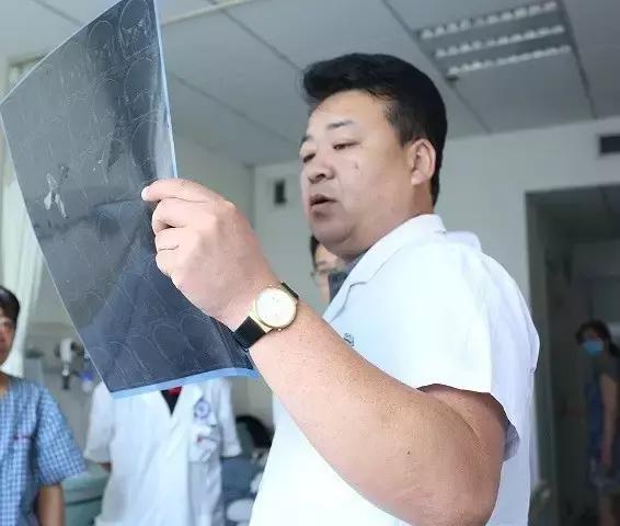 神经外科脑膜瘤,脑膜瘤怎么治疗有效果