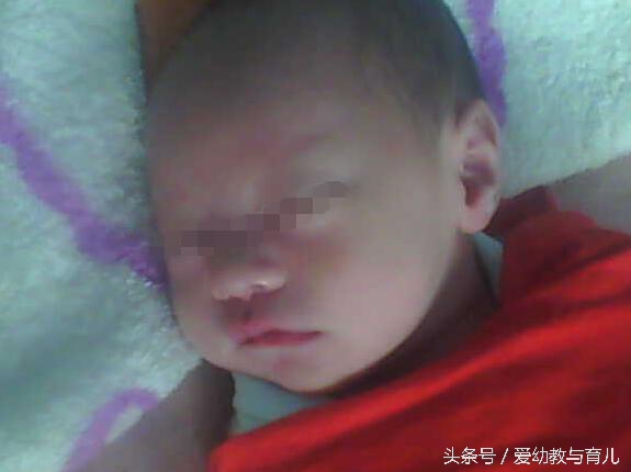 剖腹产取环有困难不,剖腹产的妇女摘环难吗