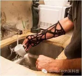 骨头断了不用打石膏,来个3D打印保护套就行,但是很贵哦