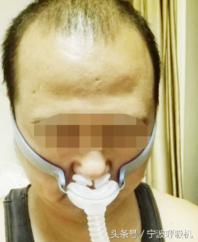 瑞思迈呼吸机面罩,瑞思迈呼吸机s9口鼻面罩