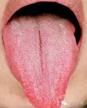身体最健康舌头是怎么样的,健康人是什么体质