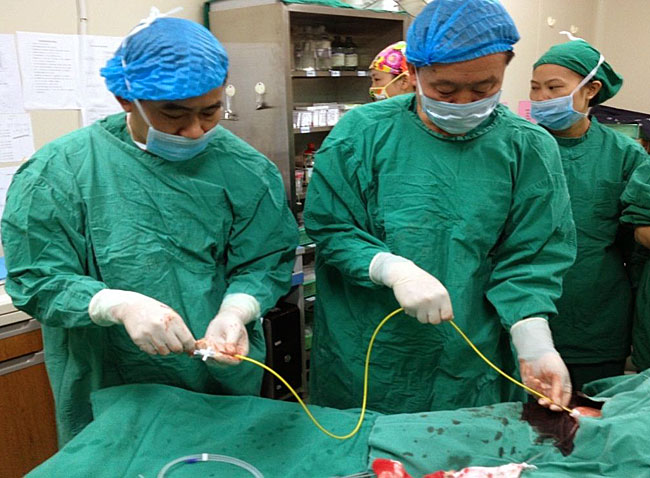 医学上导管是什么意思,半永久导管置管术