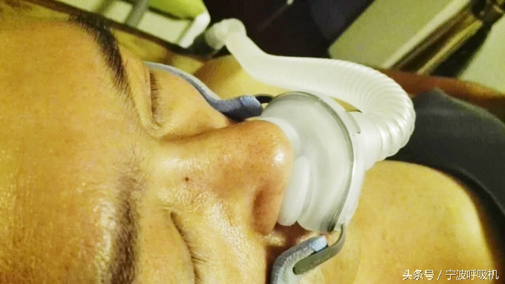 瑞思迈呼吸机面罩,瑞思迈airsense10呼吸机鼻罩