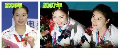 奥运冠军也爱美瘦脸箍牙后她们都美啦