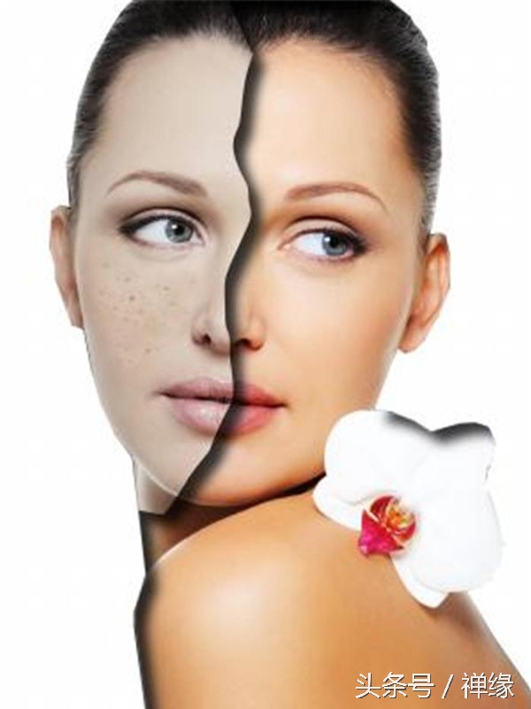 产后皮肤暗黄需要怎么护肤,产后皮肤暗黄还长痘怎么办
