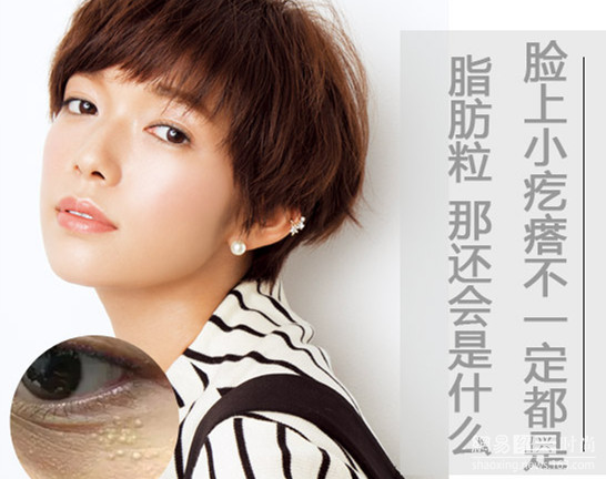 眼睛上长的小米粒是什么,眼睛起的小米粒是什么