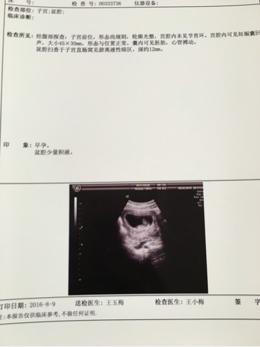 孕酮低未见胚胎什么情况,孕酮低无胎心见红腹痛