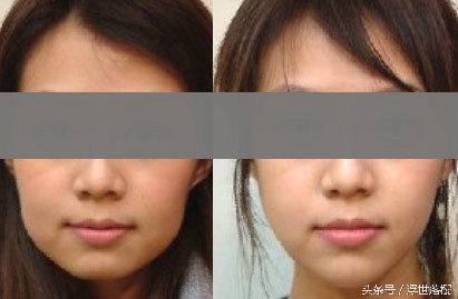 你所不知道的关于刮痧的秘密,刮痧小知识