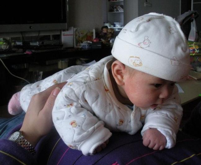 湿疹一年的亲身经历,湿疹一年多了的亲身经历