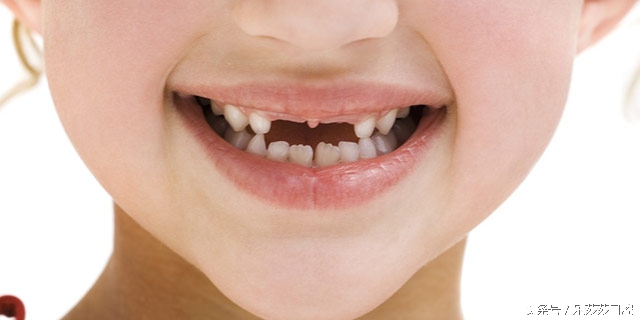 看牙医必问的5个问题,看牙医能快速止痛吗