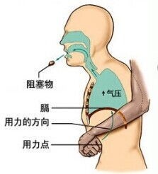 异物呛咳处理,异物卡喉的急救方法幼儿