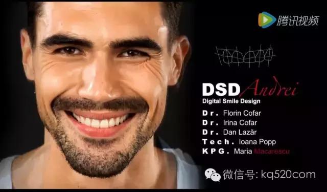 烤瓷牙变黑有必要更换吗,烤瓷牙边缘变黑怎么办