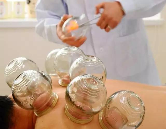 拔罐靠谱吗,拔罐真的有用吗测评