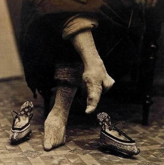 古代女子到底为什么要缠足简介,古代女子缠足的真正原因