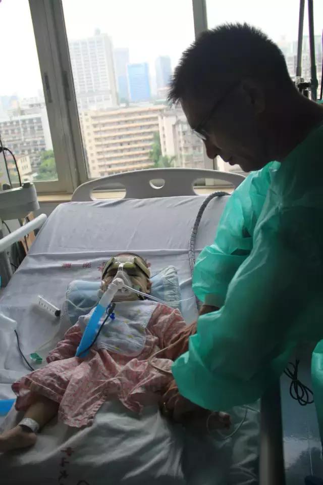 庞贝氏病全国有几例,庞贝氏症俗称什么病