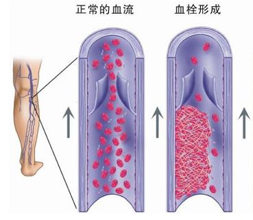 种草莓踩坑,种草莓容易犯的错