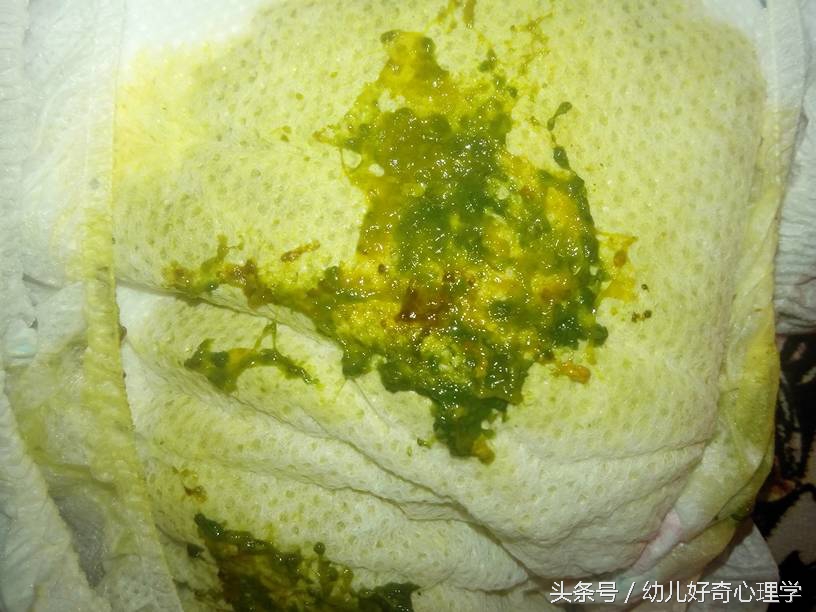 小孩拉肚子拉稀拉白色的吃什么药,宝宝拉肚子老是反反复复怎么回事